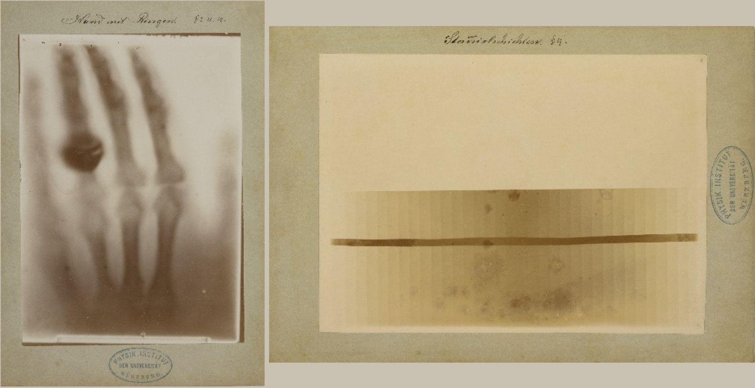 Links: Röntgenfoto door Wilhelm Conrad Röntgen: hand van Röntgens vrouw, 22 december 1895, Collectie Teylers Museum. Rechts: 
Röntgenfoto door Wilhelm Conrad Röntgen: lagen van tinfolie, Collectie Teylers Museum. Foto: Teylers Museum